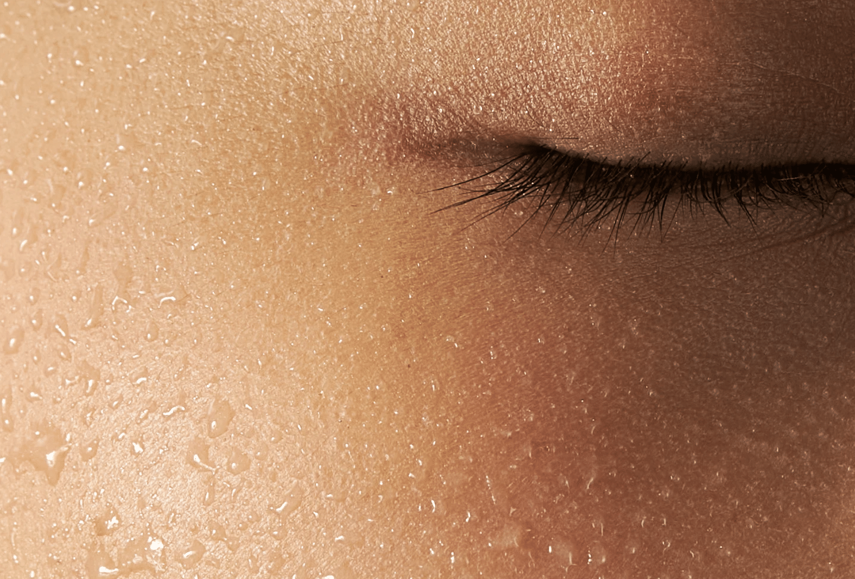 Transpiration excessive : Botox ou MiraDry, quelle solution choisir ?