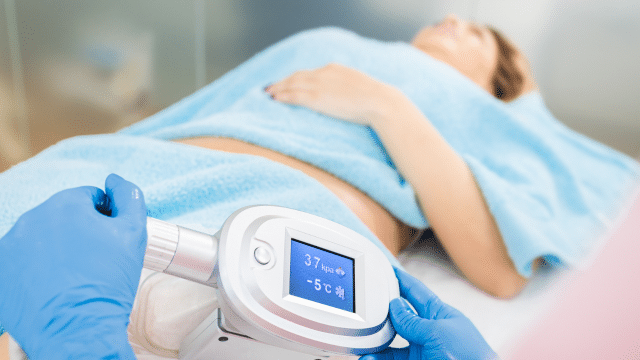 Est-il possible de reprendre mes activités quotidiennes après une séance de cryolipolyse ?