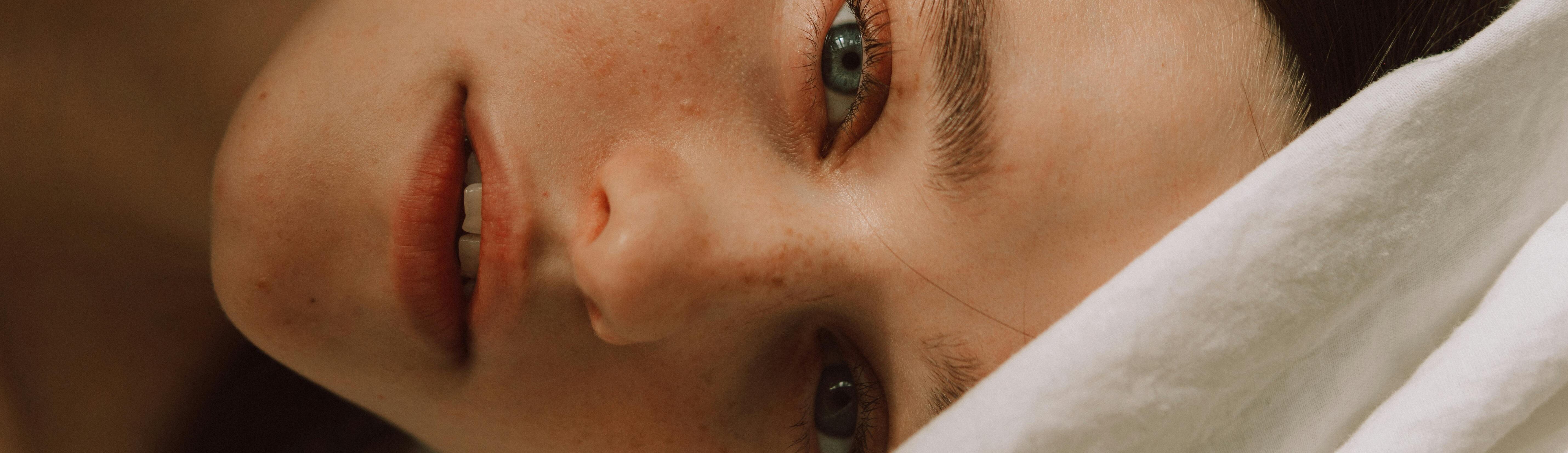 Taches brunes sur le visage : pourquoi apparaissent-elles et comment les traiter ?